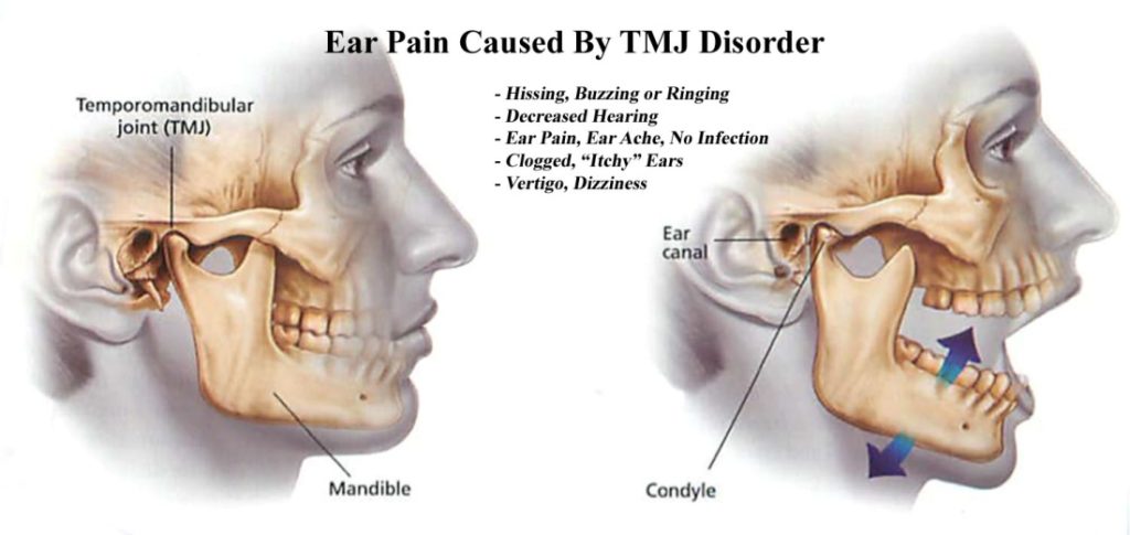 swelling-behind-ear