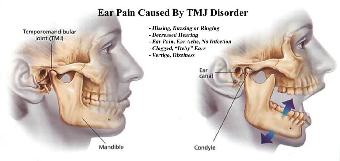 Ear Pain Ringing Head Pain Institute